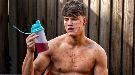 Do Protein Shakes Cause Acne? Exploring the Link Between Supplements and Skin Health